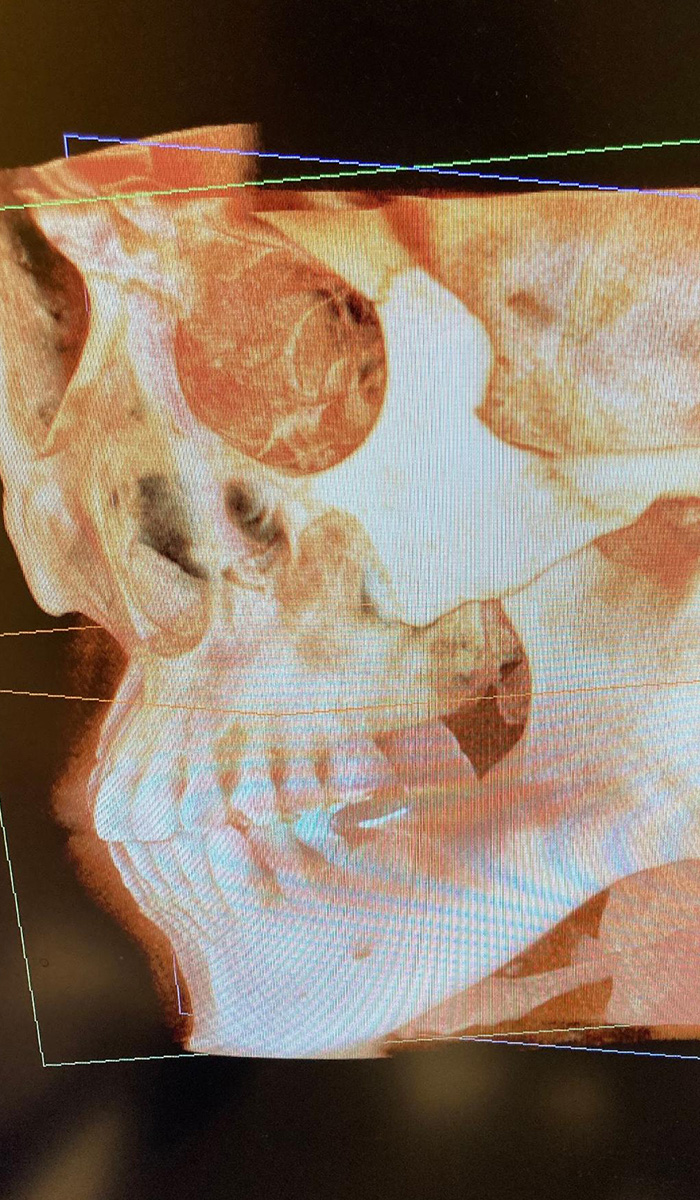 精密診断な診断を実現するための設備1