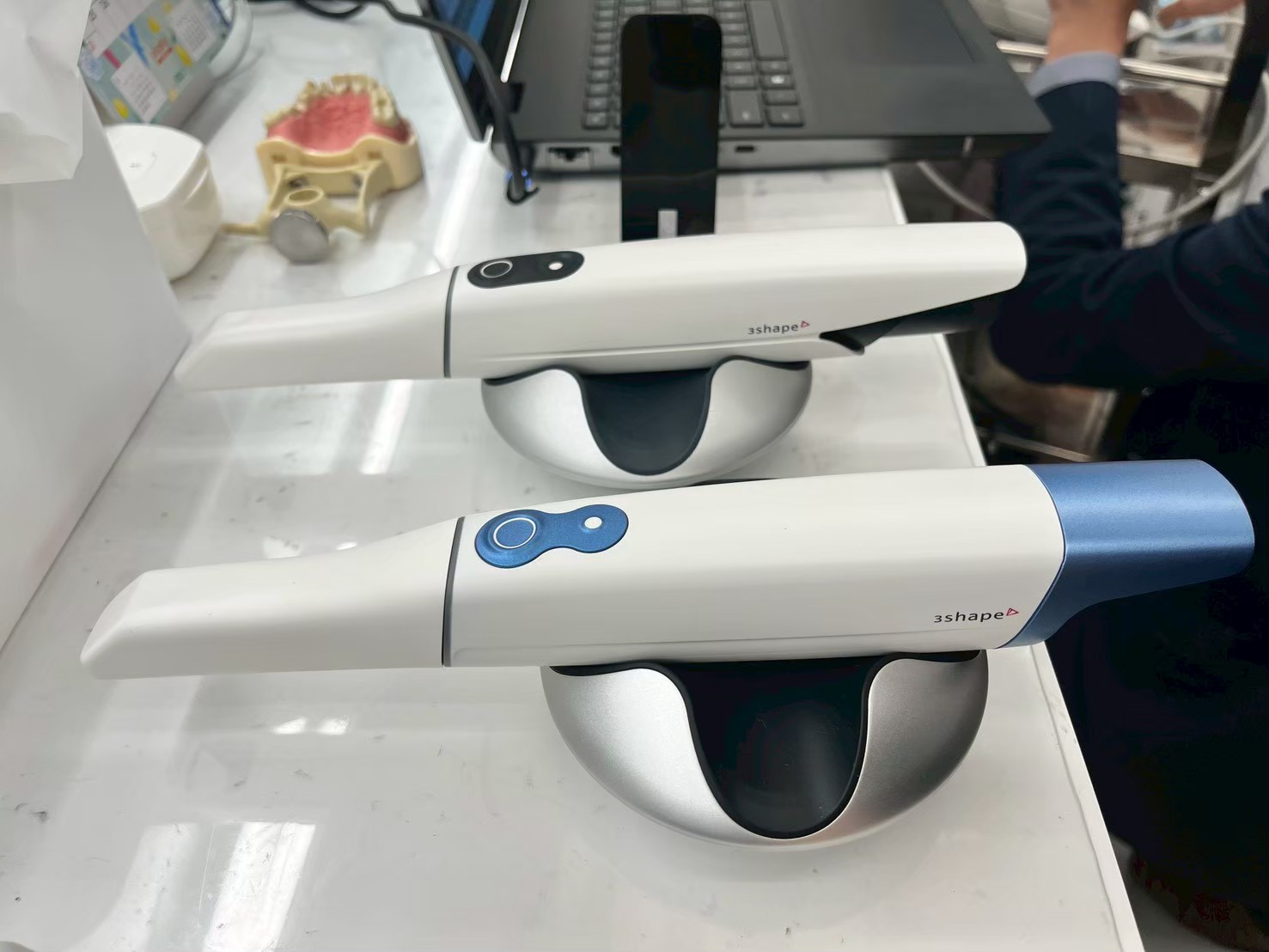 秋津・新秋津のまつばら歯科での3Dスキャン口腔内スキャナー