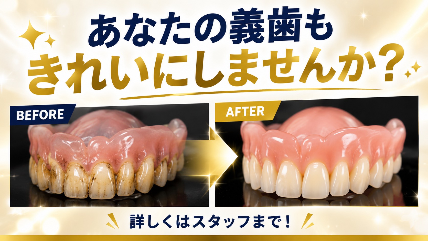 入れ歯洗浄のビフォーアフター写真