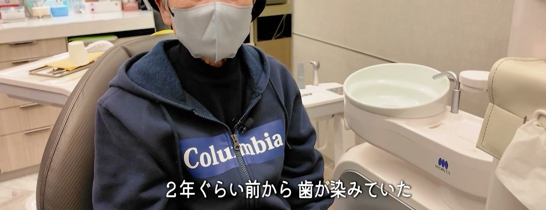 他院で抜歯が難しいと言われた経験を語る患者様｜秋津の歯医者まつばら歯科