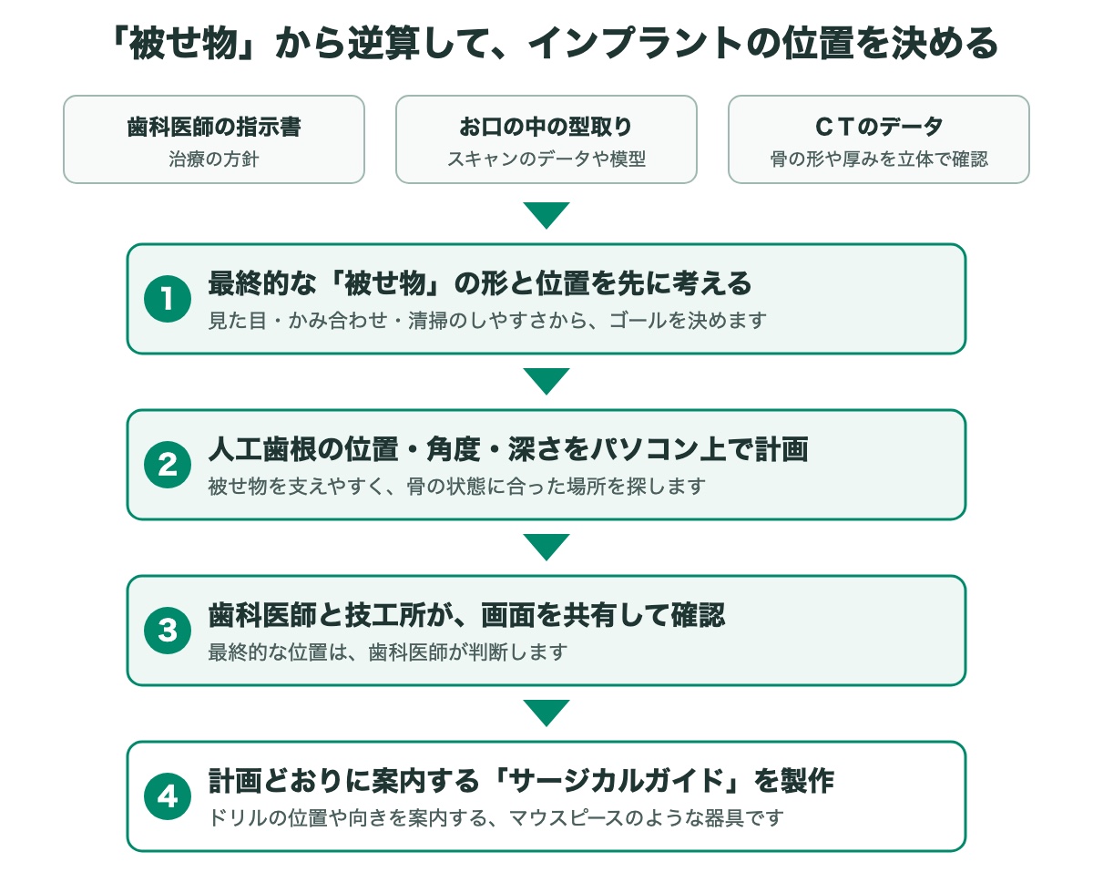 被せ物から逆算してインプラントの位置を決める計画の流れ｜東村山 歯医者 インプラント