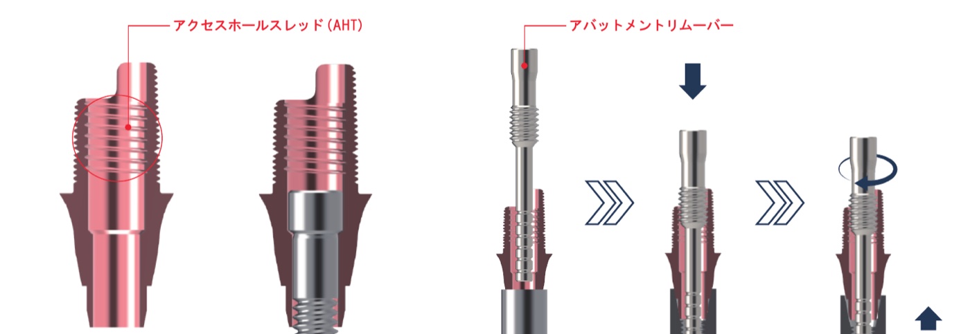 ネジ穴の内側のネジ山を使って土台を外す器具（カタログ）