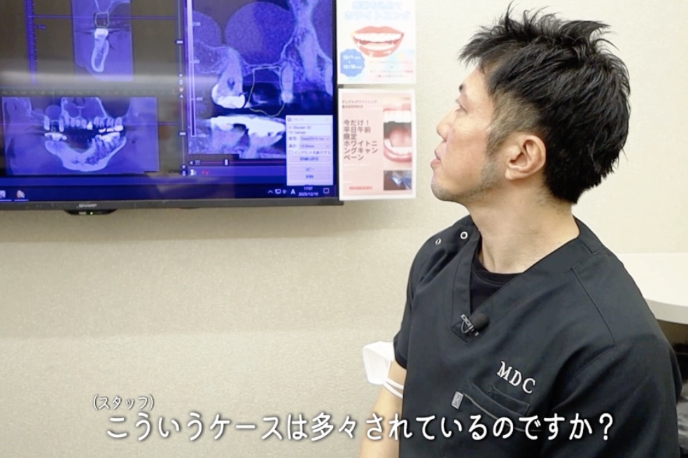 難症例について質問に答える歯科医・松原幹朗先生|東村山の歯医者 まつばら歯科