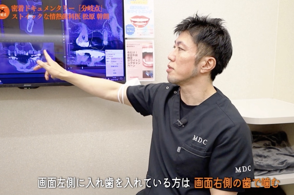 画面左側に入れ歯を入れている方は画面右側の歯で噛むとＣＴ画像を指して説明する松原幹朗先生｜新秋津・秋津駅前まつばら歯科