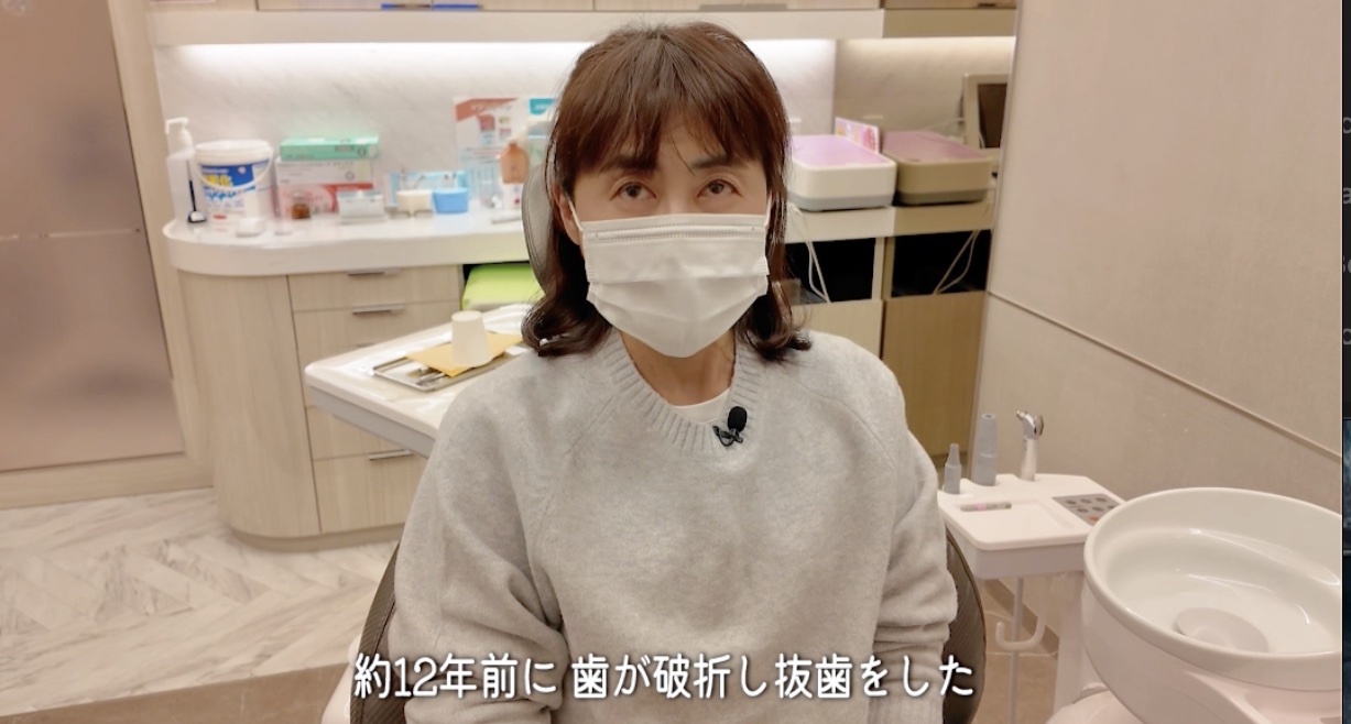 約１２年前に歯が破折し抜歯したと語る女性患者様｜秋津のインプラント 新秋津・秋津駅前まつばら歯科