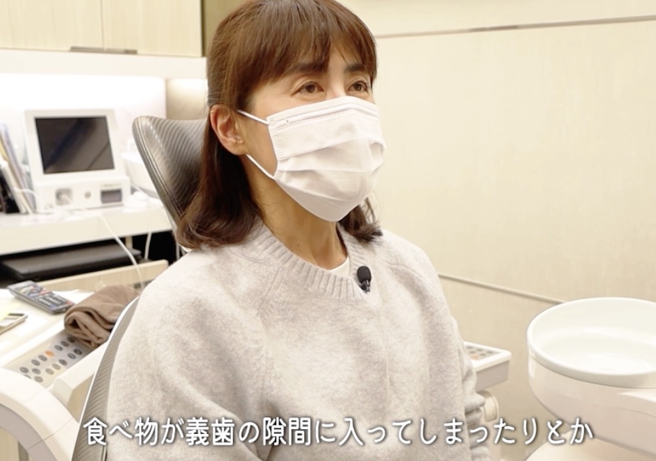 部分入れ歯の不便さを語る女性患者様｜秋津でインプラントを検討する方へ まつばら歯科